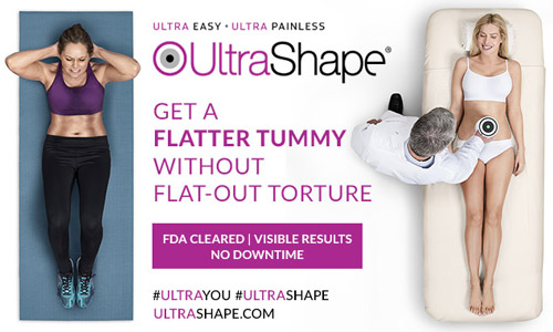 UltraShape procedure review