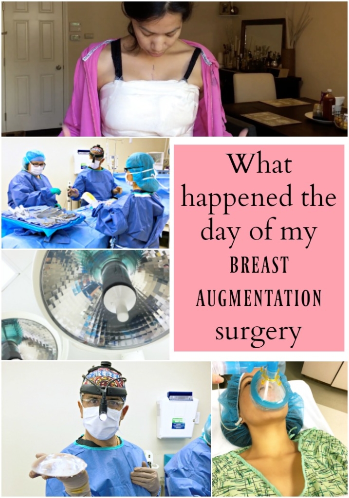 What happens the day of breast augmentation surgery