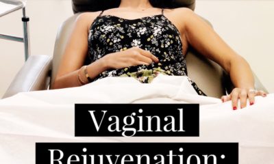 Vaginal Rejuvenation: What you need to know before your first treatment - livingmividaloca.com